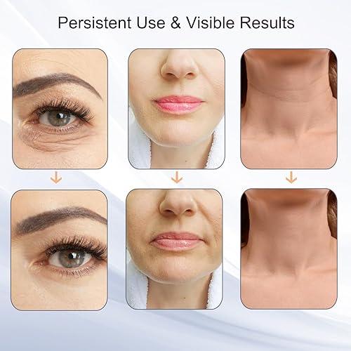 Anti-Aging Facial Massager